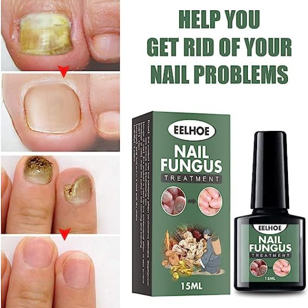 Ulje za gljivice i ispucale nokte